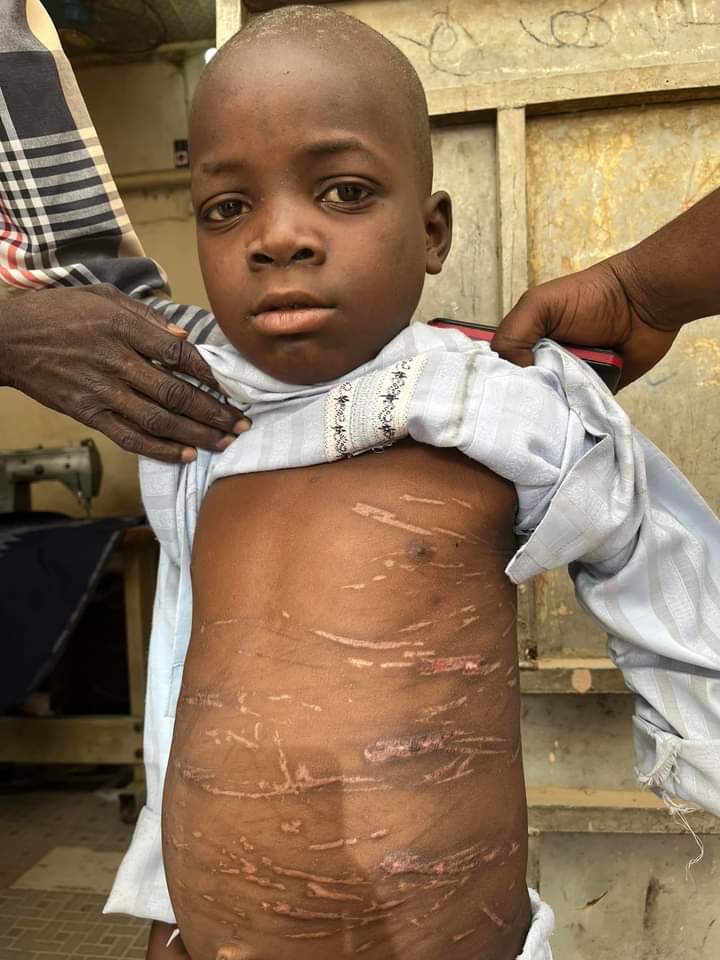An tsinci wani ƙankanin almajiri da tabubbukan duka a jikinsa a Kano An tsinci wani ƙankanin almajiri da tabubbukan duka a jikinsa a Kano