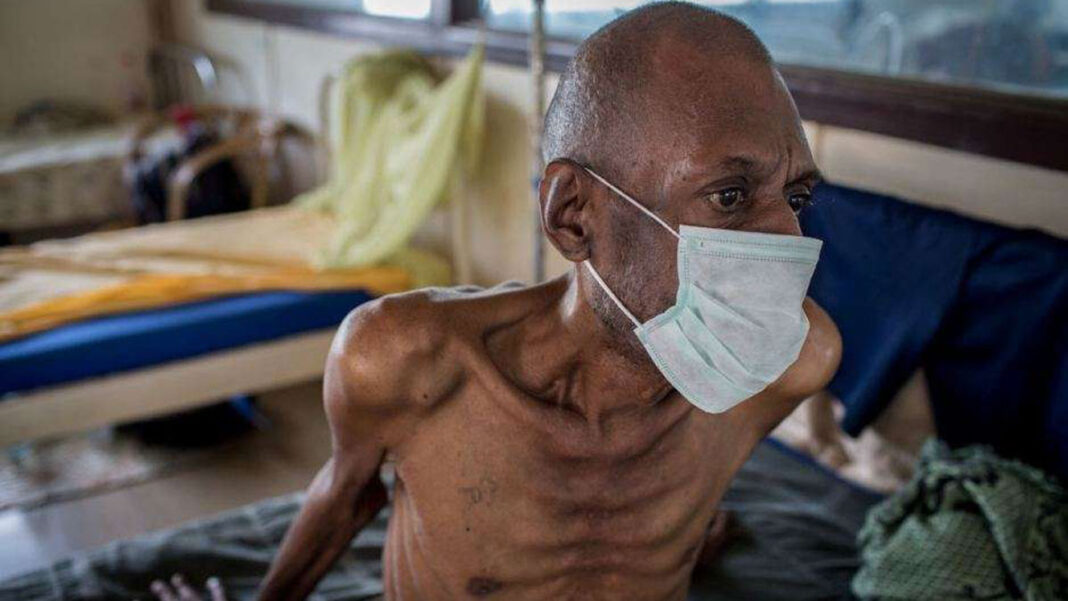 A tuberculosis patient