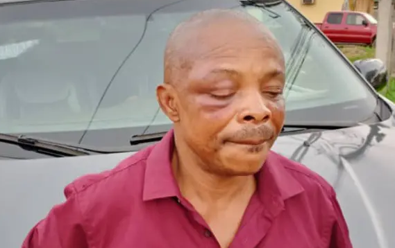 Brutalised Joe Ajaero